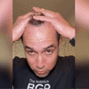 Hair Growth Spray