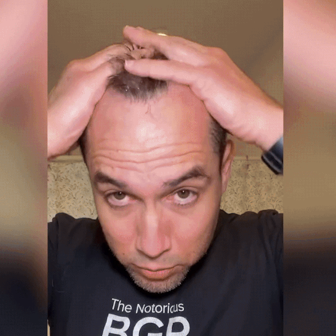 Hair Growth Spray