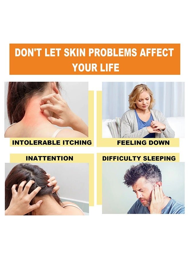 South Moon - Bee Venom Psoriasis Care Cream