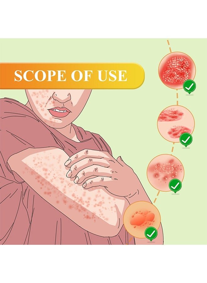 South Moon - Bee Venom Psoriasis Care Cream
